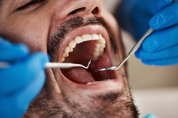 Best After-Hours Dental Trauma Care in Cambridge, MN