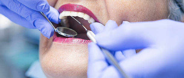 Best Emergency Tooth Extraction in Cambridge, MN